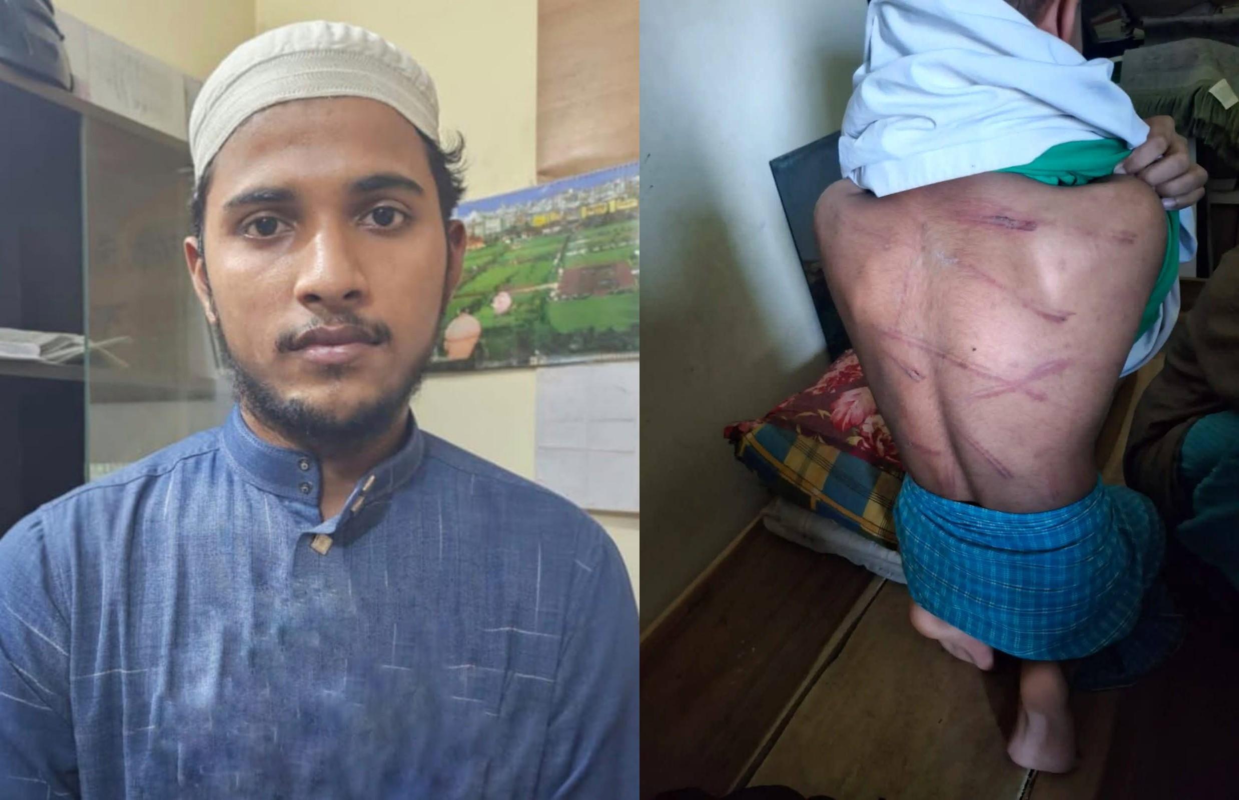 শিক্ষার্থীকে বেধড়ক বেত্রাঘাত, মাদ্রাসা শিক্ষক গ্রেপ্তার