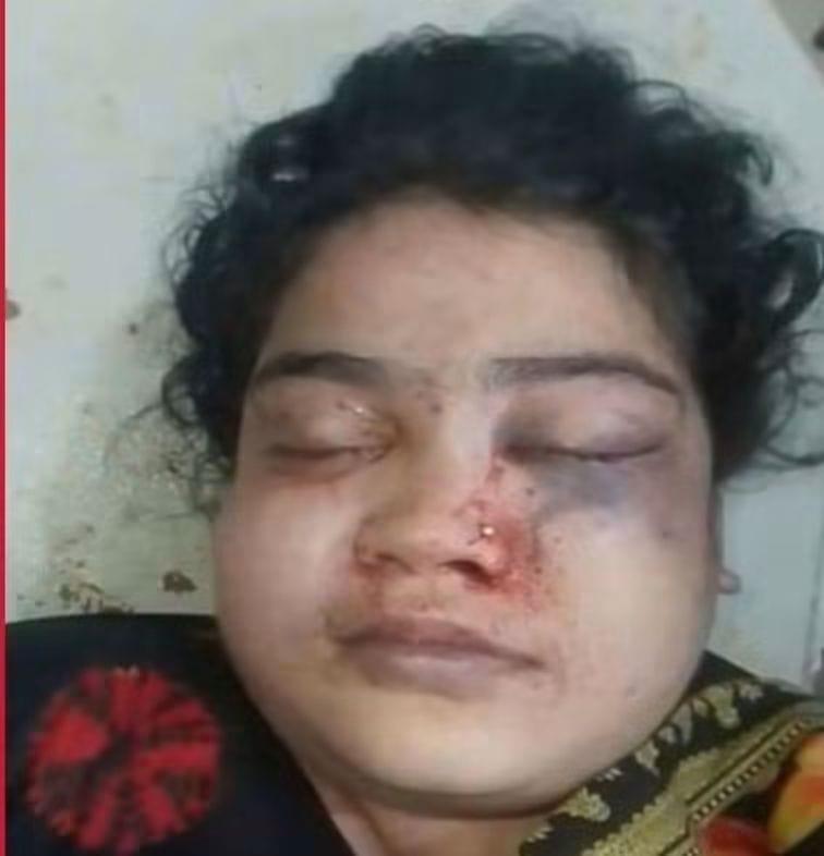 সংযুক্ত ছবি