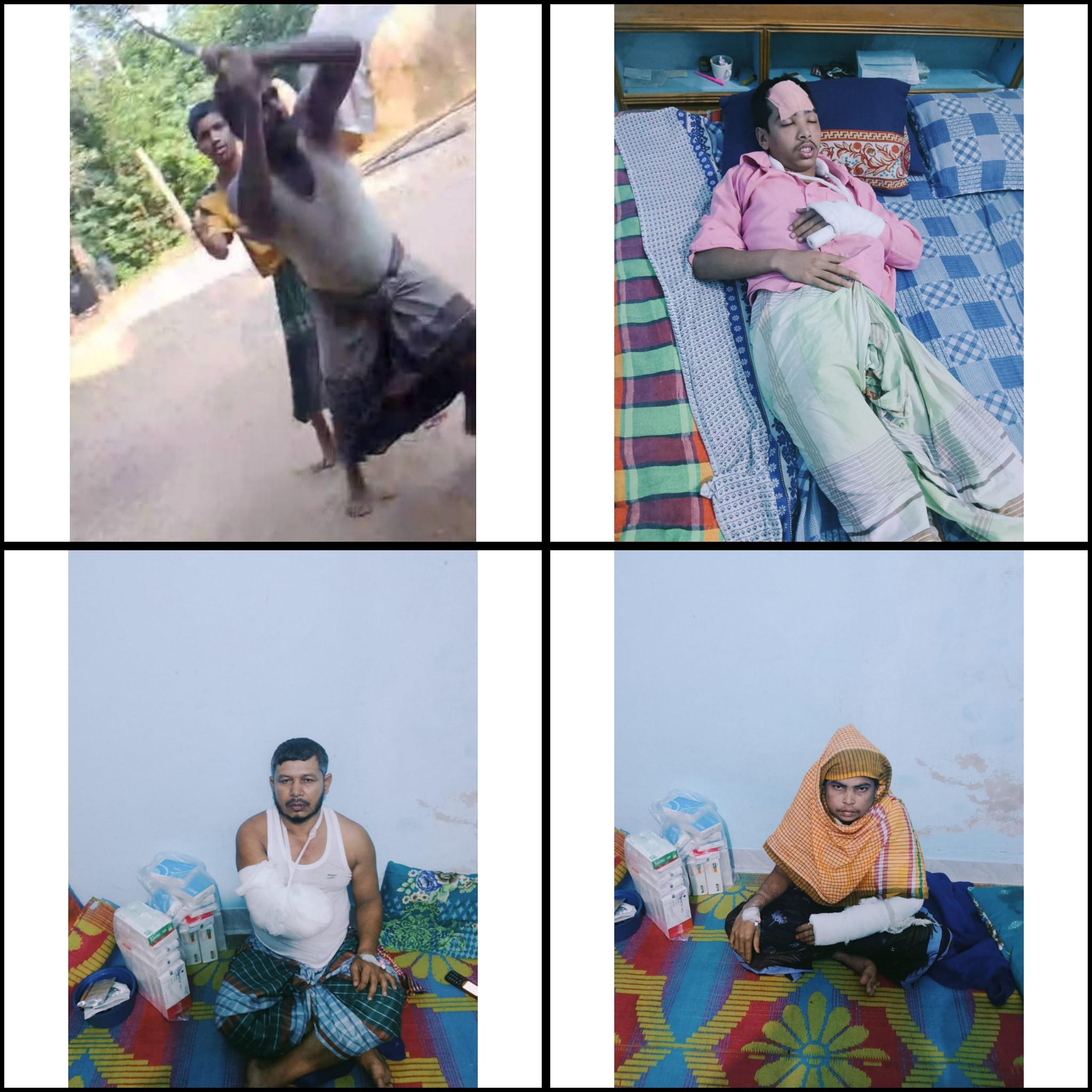 পেকুয়ায় দায়ের কোপে ভগ্নিপতির হাত ও বোনের আঙুল বিচ্ছিন্ন, ভাগিনার মাথায় জখম
