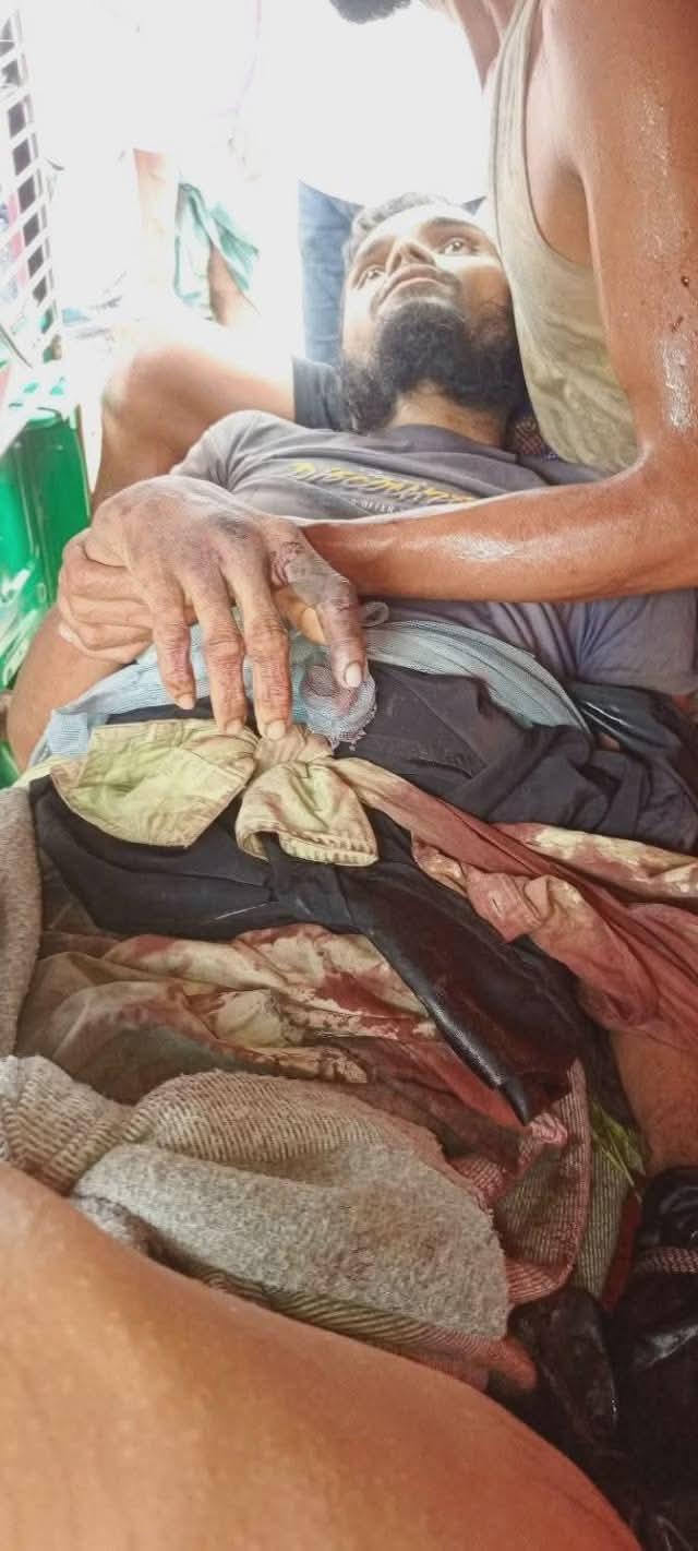 নাইক্ষ্যংছড়িতে স্থলমাইন বিস্ফোরণে  রোহিঙ্গার বাম পা বিচ্ছিন্নের পর রক্তক্ষরণে  মৃত্যু
