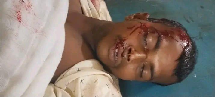 <h1>সীতাকুণ্ডে অজ্ঞাত গাড়িৱ চাপায় পথচাৱীৱ মৃত্যু</h1>