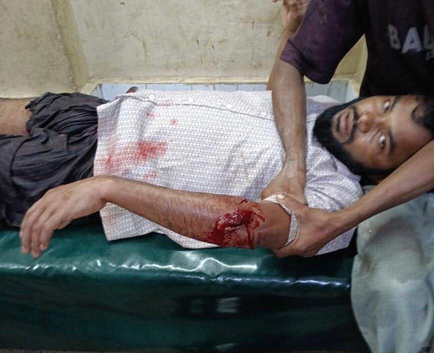 ছাত্রলীগ থেকে যুবদলে এসে পেশাজীবি দল সদস্যকে ছুরিকাঘাত