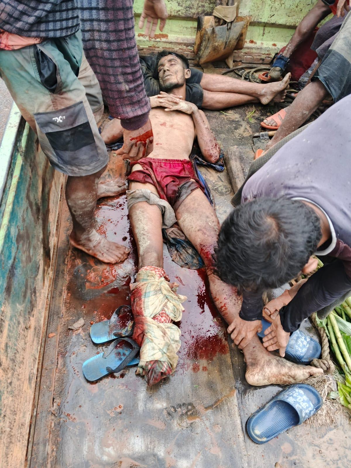 <h1>ঘুমধুম সীমান্তে ফের ল্যান্ডমাইন বিস্ফোরণ,উড়ে গেল যুবকের বাম পা<br />
</h1>