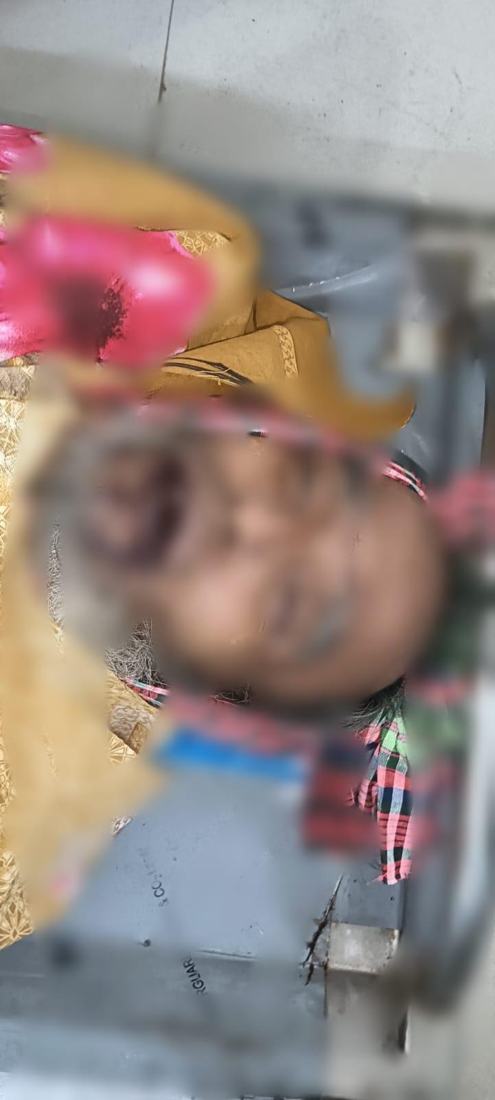 <h1>পানির বোতল ভেবে এসিড পান: রামুতে শ্রমিকের মৃত্যু</h1>