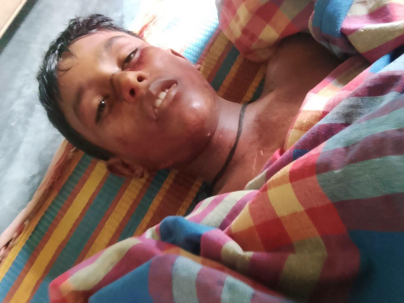 <h1>জামগাছ থে&zwnj;কে পড়ে শিক্ষার্থীর মৃত&zwnj;্যু</h1>