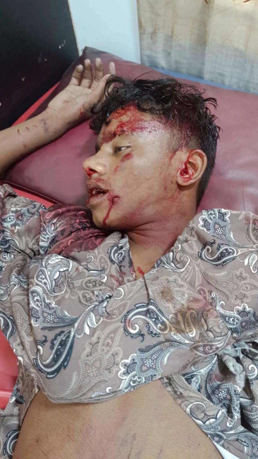কানে হেডফোন লাগিয়ে রেললাইনের পাশ দিয়ে হাঁটছিল কিশোর, ট্রেনের ধাক্কায় মৃত্যু