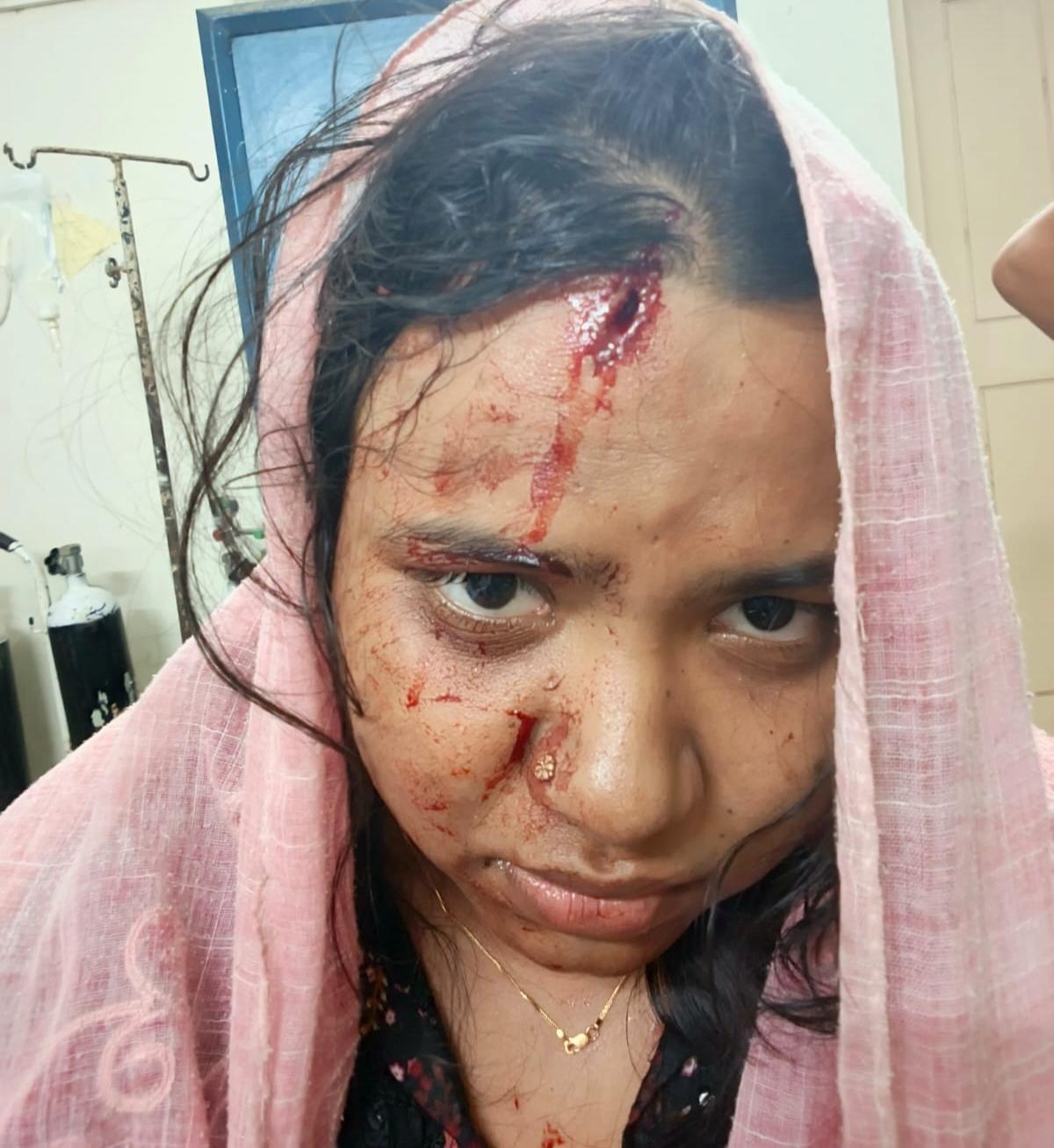 চিকিৎসক মেয়েকে অধ্যক্ষ বাবার হাতুড়িপেটা
