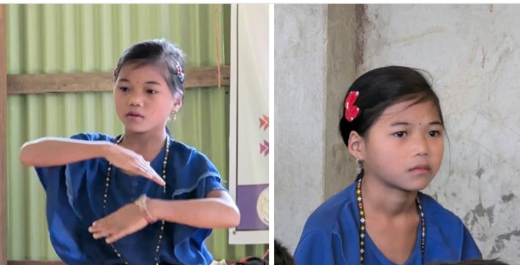 আলীকদমে হামে  আক্রান্ত ১ শিশুর মৃত্যু